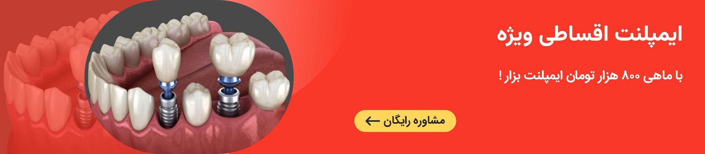 بنر تبلیغاتی