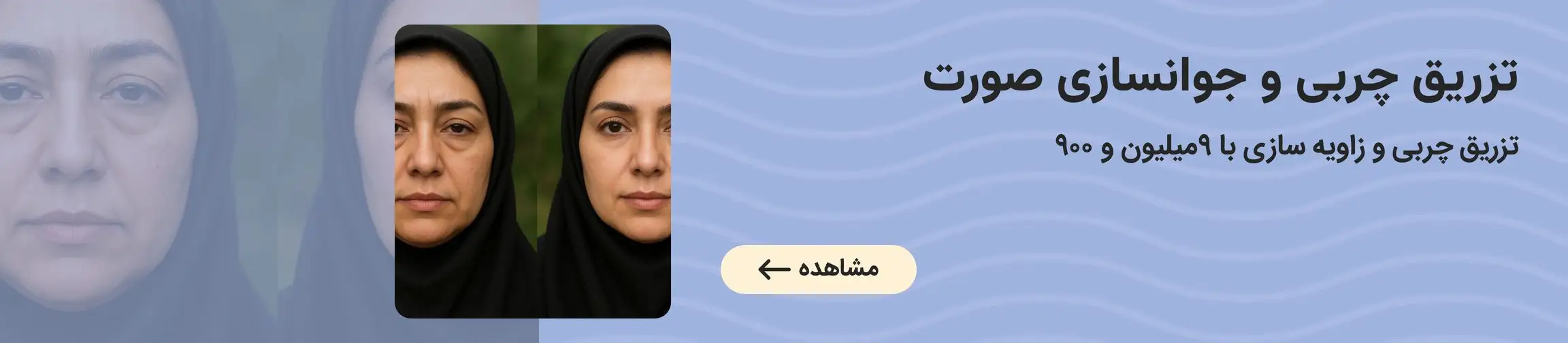 بنر تبلیغاتی