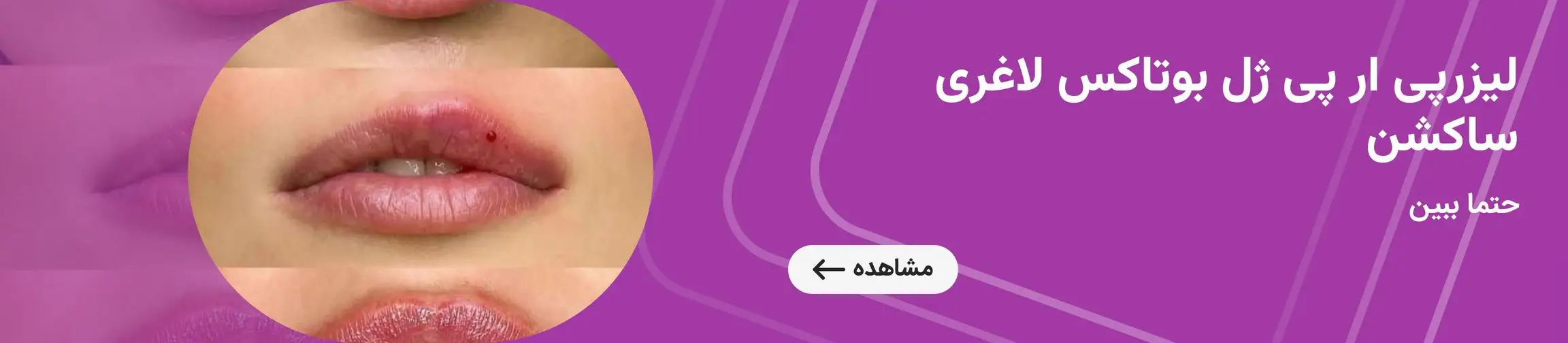 بنر تبلیغاتی