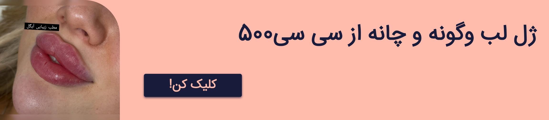 بنر تبلیغاتی