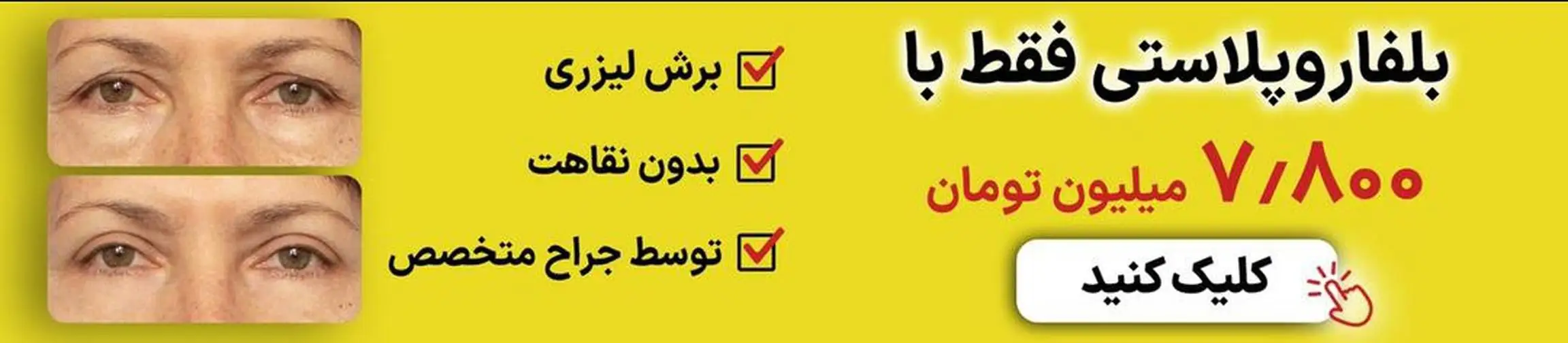 بنر تبلیغاتی